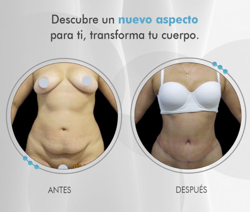 Clinmedic, clínicas de cirugía plástica de Pereira
