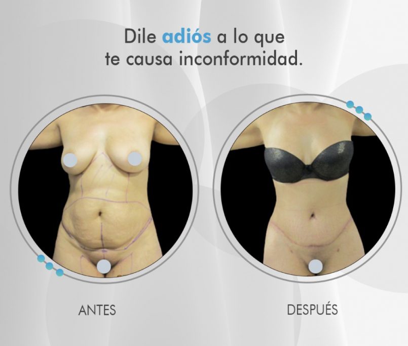 Clínica de cirugía plástica de Pereira