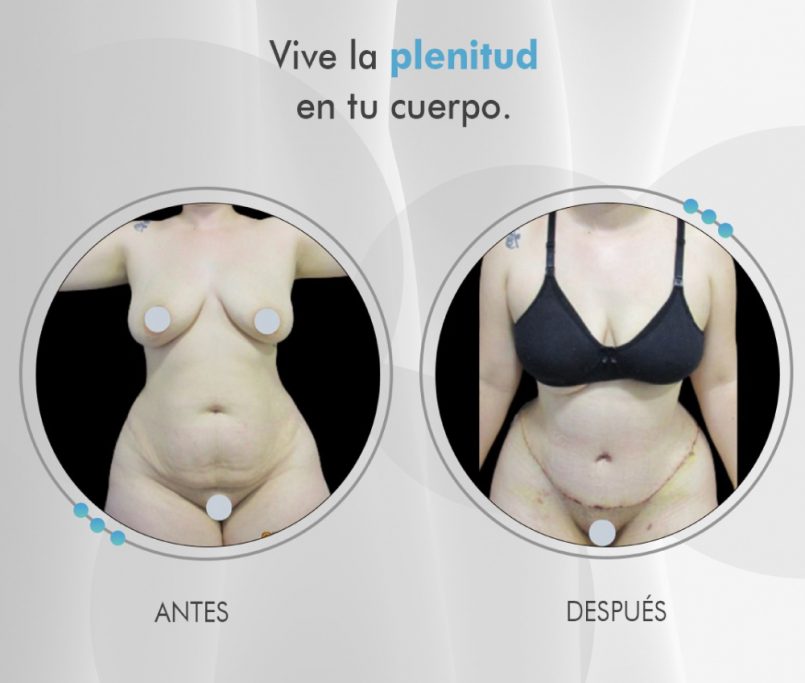 Clínicas de cirugía plástica de Pereira