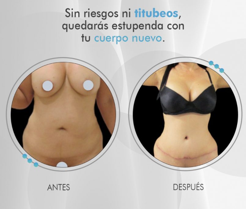 Clinmedic, clínica estética en Pereira