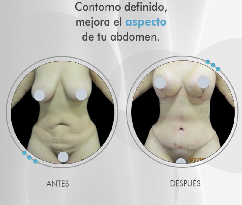 Clinmedic, clínicas estéticas en Pereira